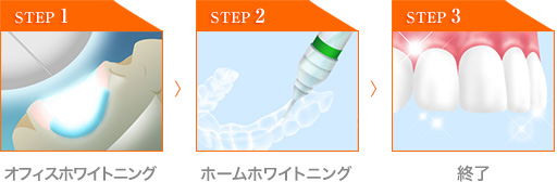 オフィスホワイトニング→ホームホワイトニング→終了